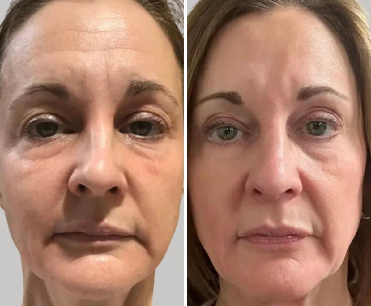 ANNA LED Facial Mask 7 Color Light Therapy